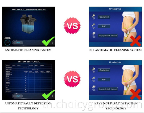 Choicy 360 Degree Fat Freezing Cryotherapy Machine